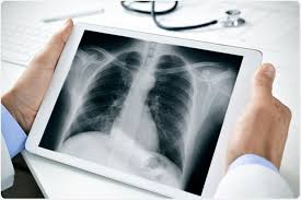 Digital Radiography ( X-ray )