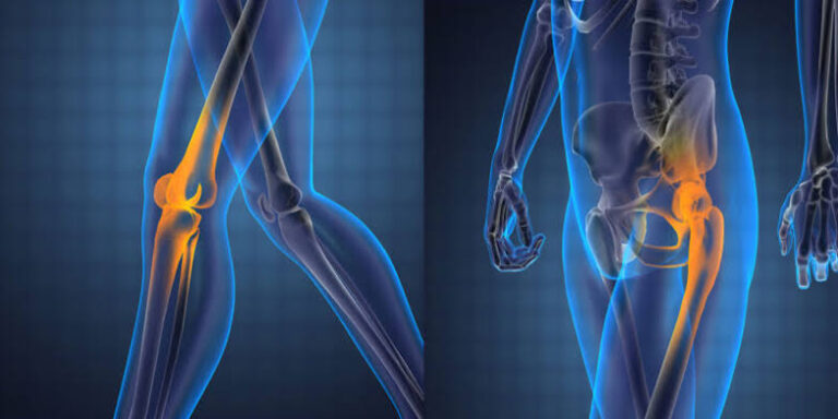 Hip and Knee Joint Pain Treatment